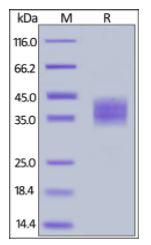 Human B7-H3, His Tag on SDS-PAGE under reducing (R) condition. The gel was stained overnight with Coomassie Blue. The purity of the protein is greater than 95%.